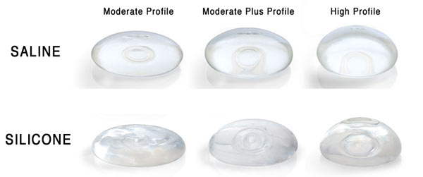 MTF breast implants - saline vs. silicone