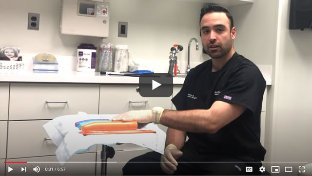 Dr. Gabriel Del Corral - Vaginoplasty Dilation Instructional Video