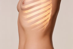 The Complete Guide to Rib Remodeling Surgery